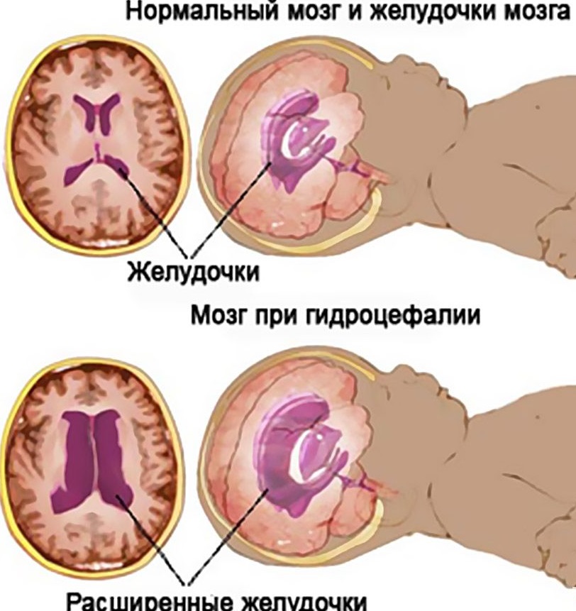 Как лечить ячмень на глазу у годовалого ребенка Как лечить ячмень на глазу у годовалого ребенка