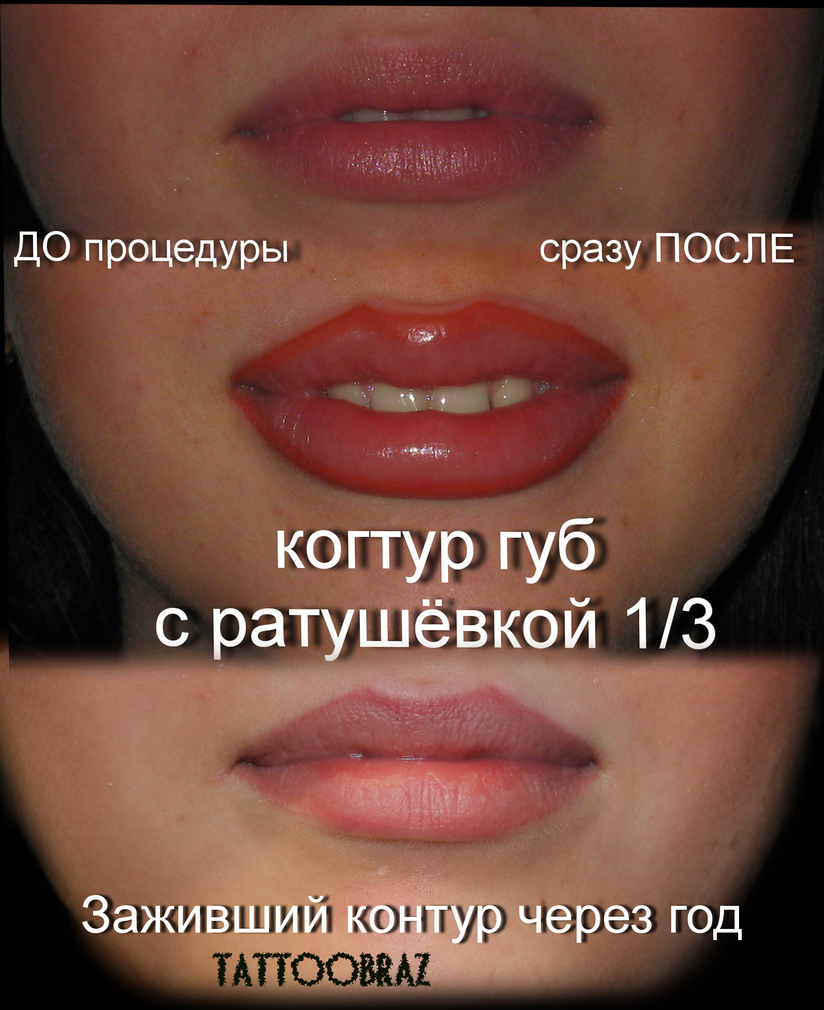 Как долго заживает татуаж на губах Как долго заживает татуаж на губах