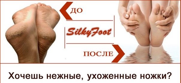 Silky -     !