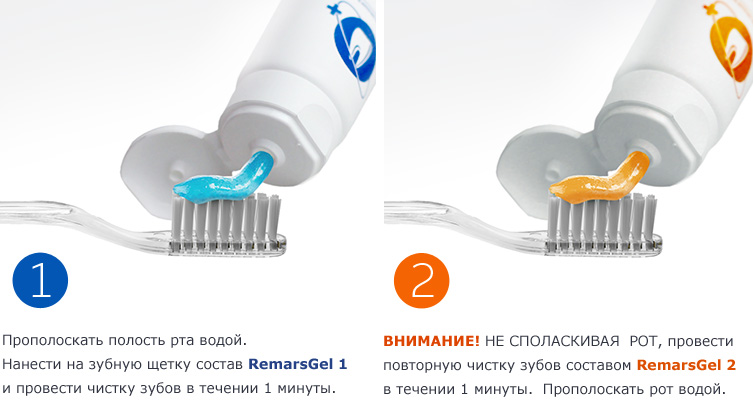   !    !  -  RemarsGel.  ,  -10