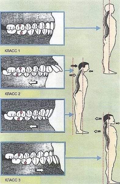 Натия Курашвили "Стоматология - это не кариес-пломба-коронка"