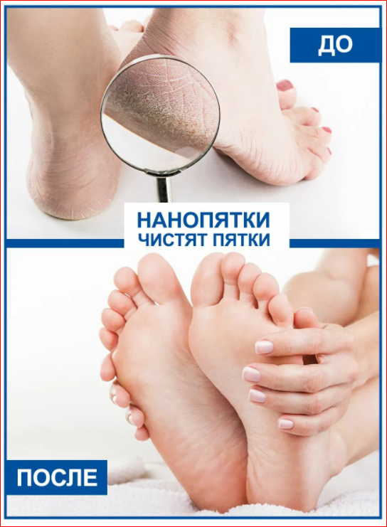      ( 18.03).  .    70 %  .   270.,  =  .  REGU-AGE,     .  .   550. . 