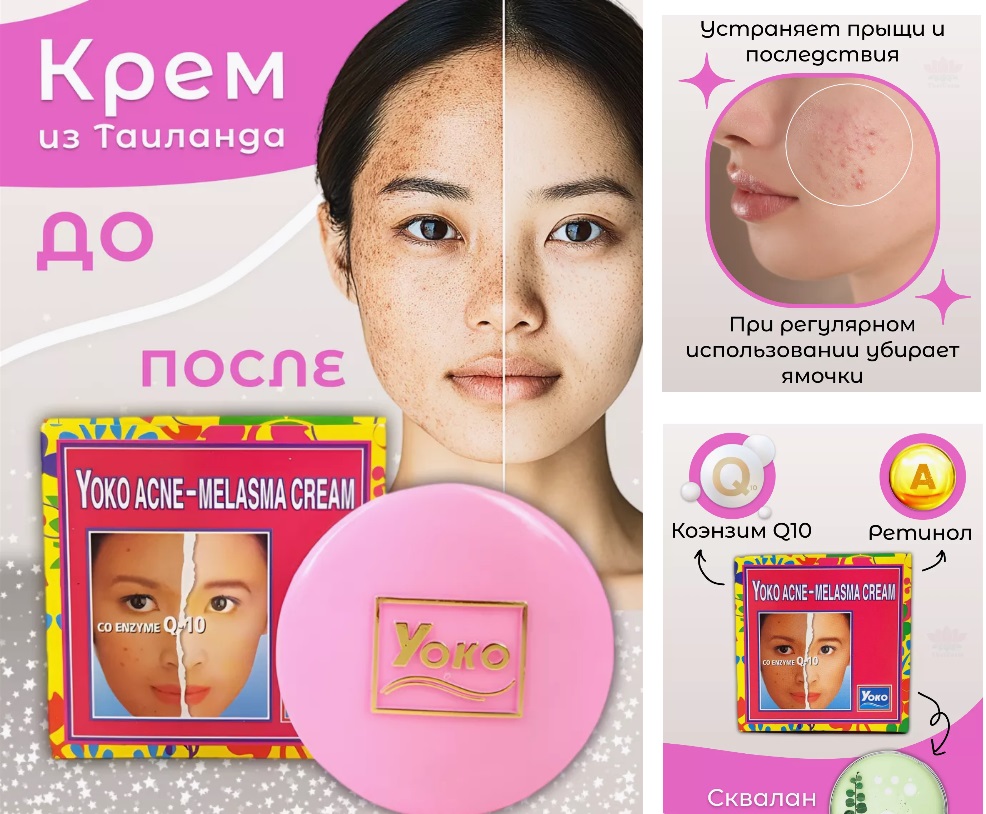 Тайский крем от прыщей и пигментации!! РАСПРОДАЖА! 55р+%, в рознице 290р!