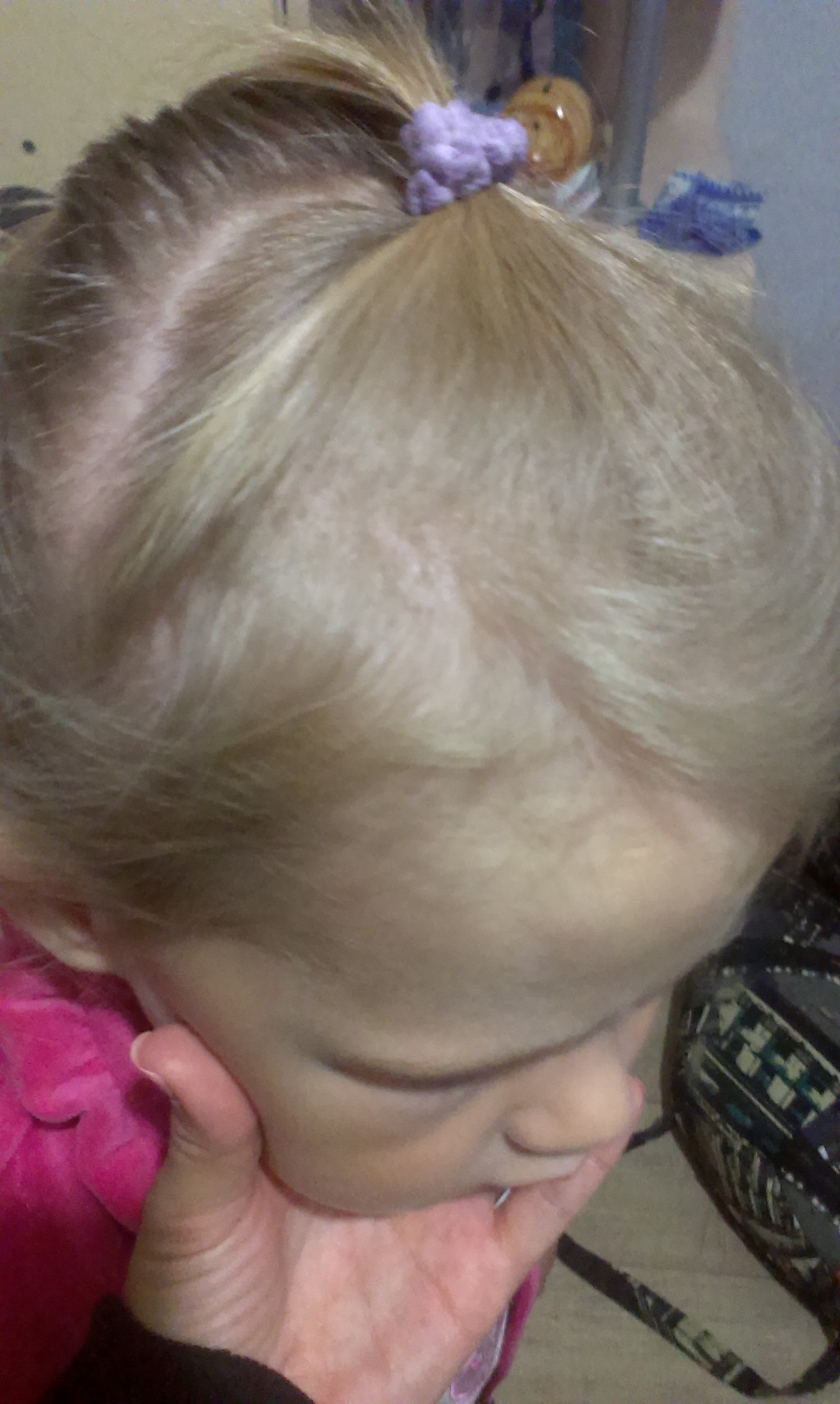 5 лет девочка не растут волосы. Редкие волосы у ребенка 3 года. Лысый затылок у грудничка. Редкие волосы у ребенка 3 года. У ребенка плохо растут волосы на голове.