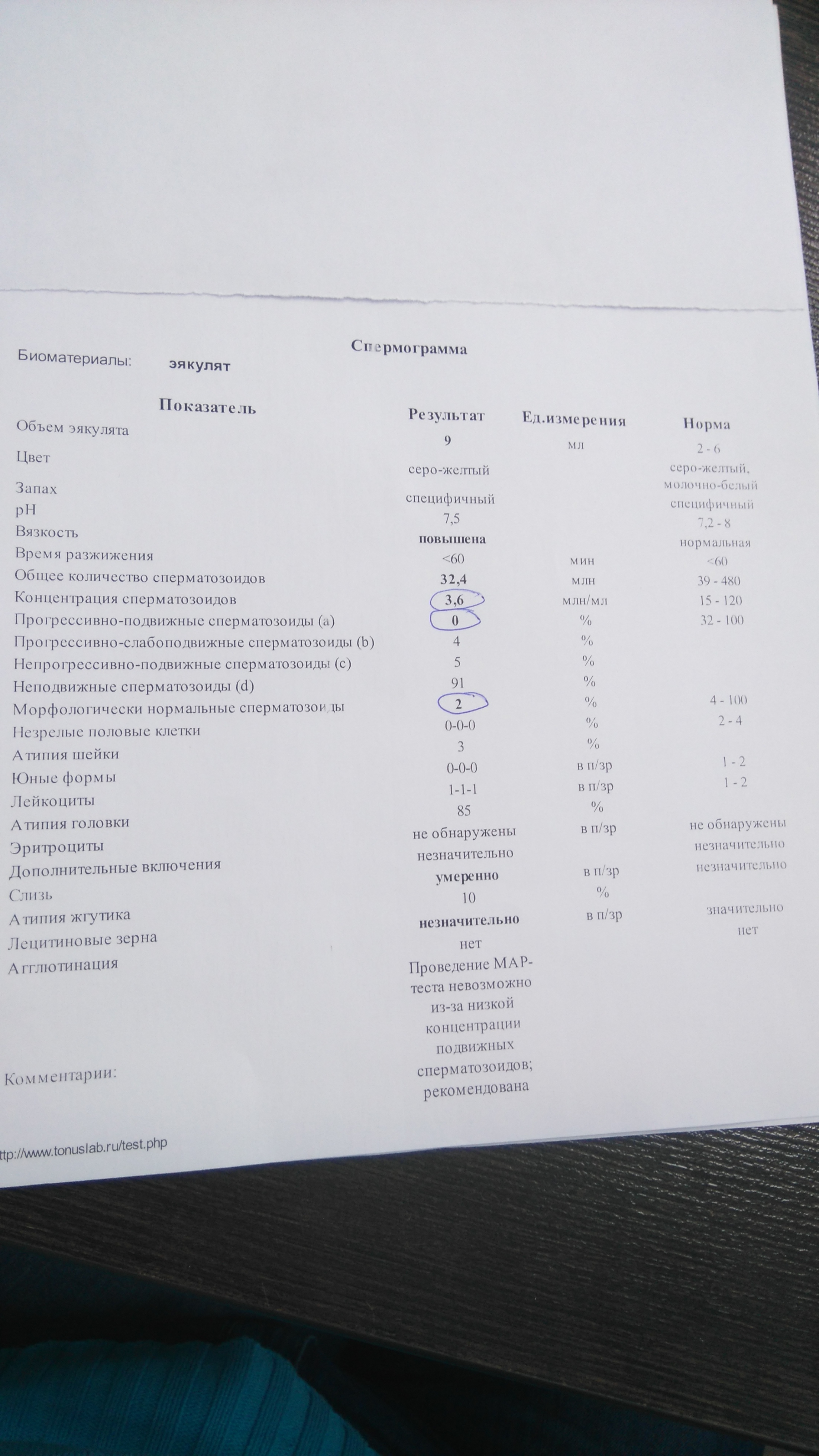 Плохая спермограмма причины. Плохая спермограмма причины. Плохая спермограмма причины. Спермограмма результаты. Плохая спермограмма.