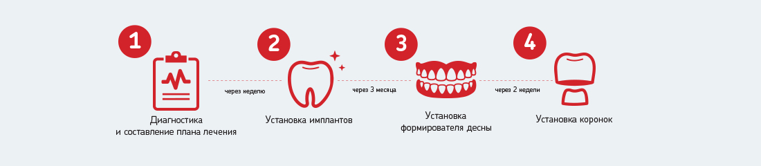 План лечения при имплантации зуба