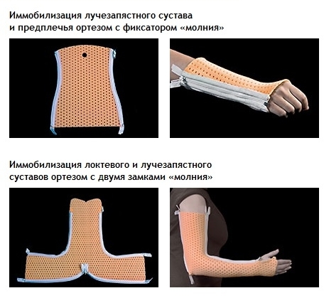 Купить Пластиковый Гипс Для Руки В Ижевске