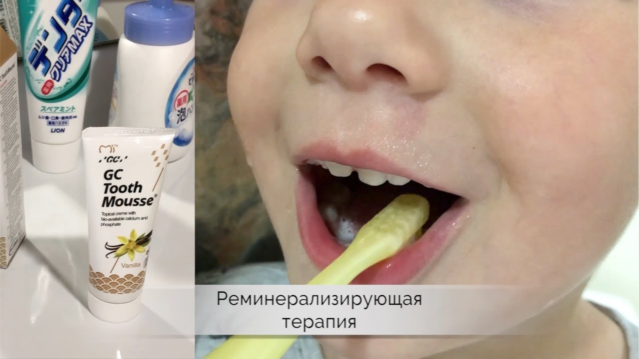 Что Будет Если Не Чистить Зубы Фото