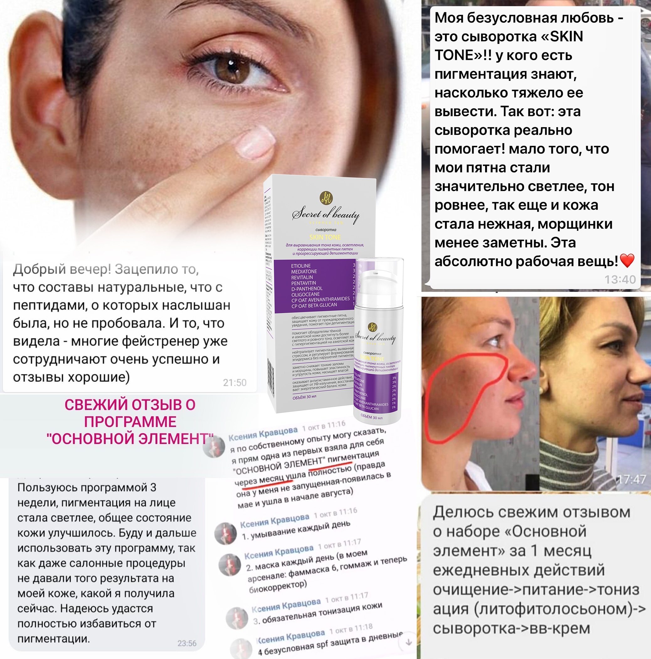 Чемеричную воду можно использовать на кожу рук от пигментации