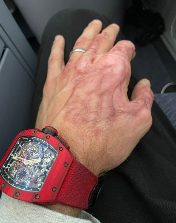 Госпитализированного после аварии на болиде Грожана могут выписать 1 декабря. Сп